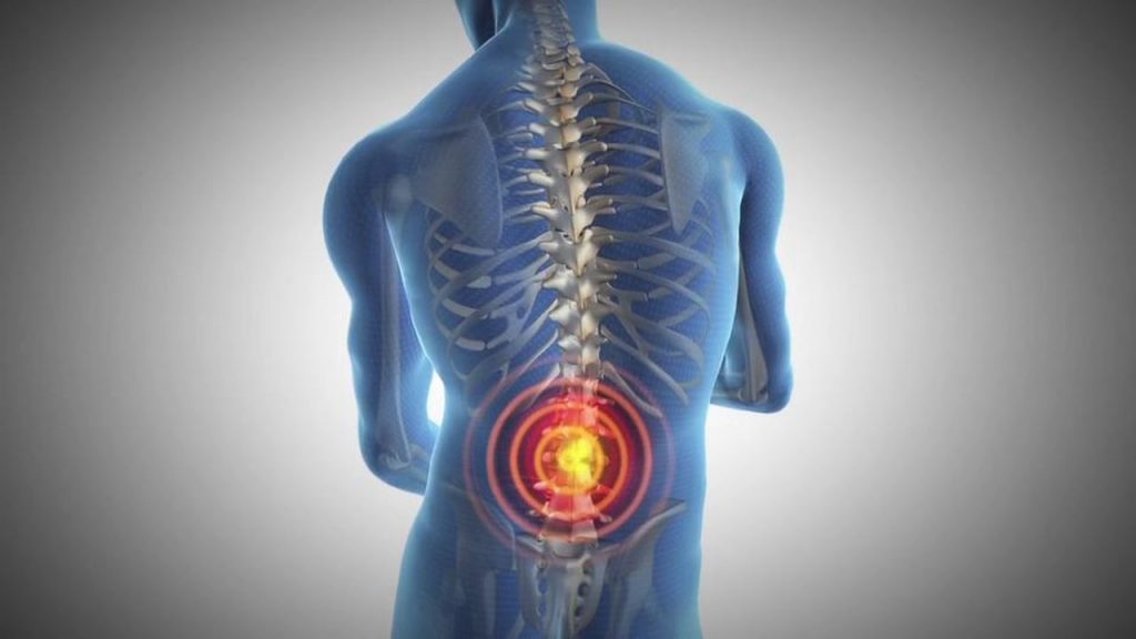 lower_back_pain